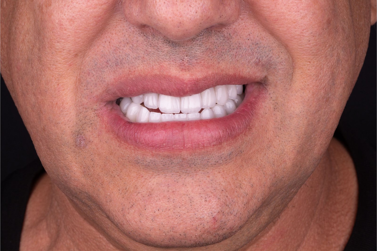 20-scaled.jpg