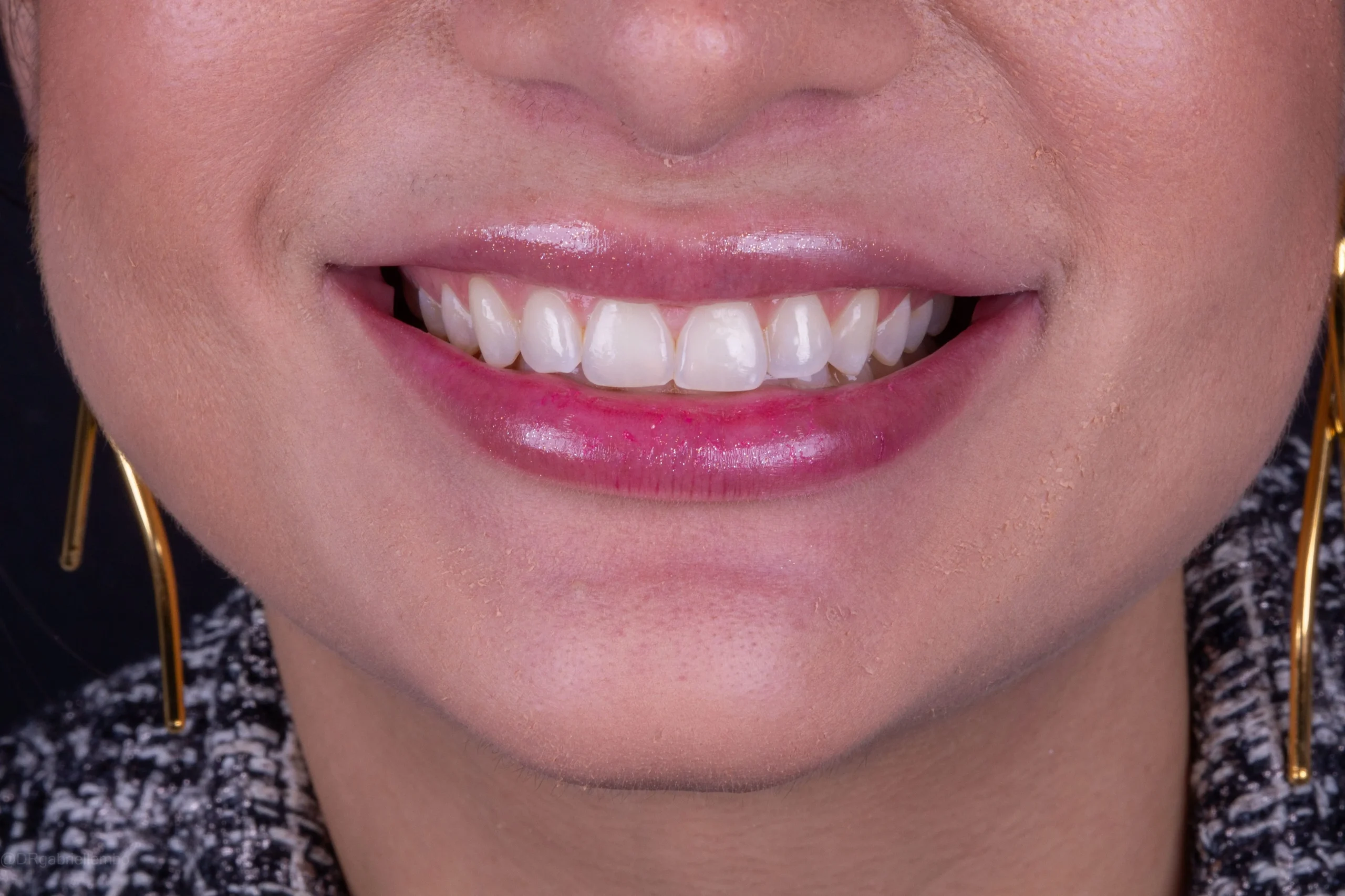 MG_2629-_1_-_1_-scaled.webp